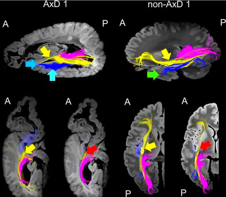 影像量化分析界面，显示测量数据和图表